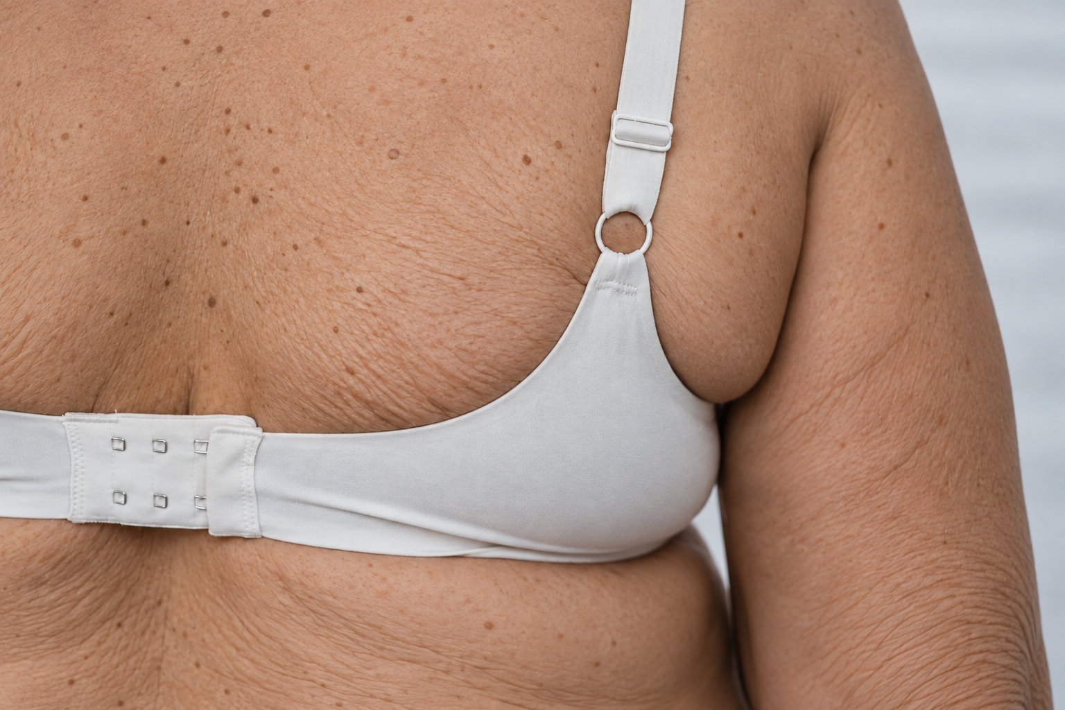Detalhe das costas de uma mulher madura mostrando dobras na pele